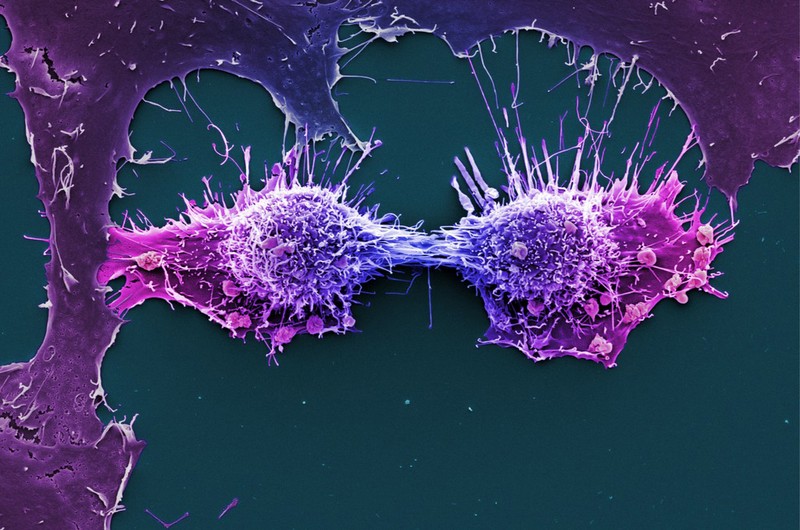 Hela Cells Immortal Human Epithelial Cancer Cell Line Sem Wellcome