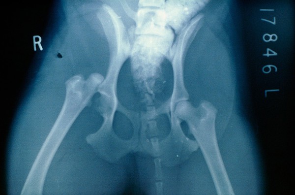 X-ray depicting dislocation of a dog's hip