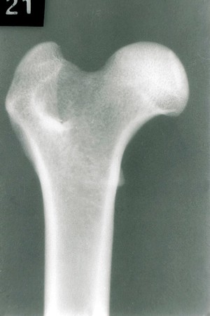 view X-ray: isolated femur of dog, proximal end