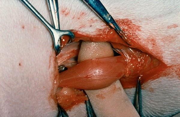 Muscle dissection for pectineal resection