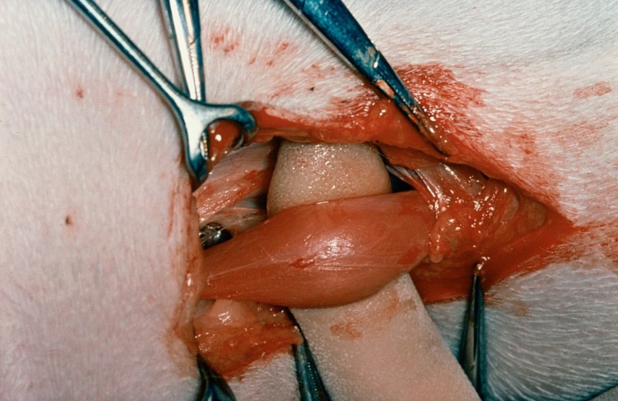 Muscle dissection for pectineal resection