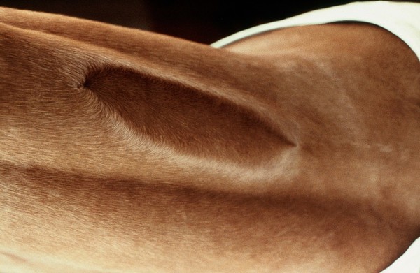 A horse's neck: two whorls conjoined by circular