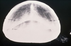 view Radiograph of tortoise - cranio-caudal view