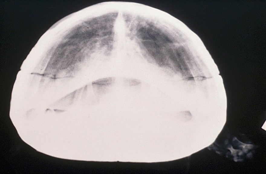 Radiograph of tortoise - cranio-caudal view