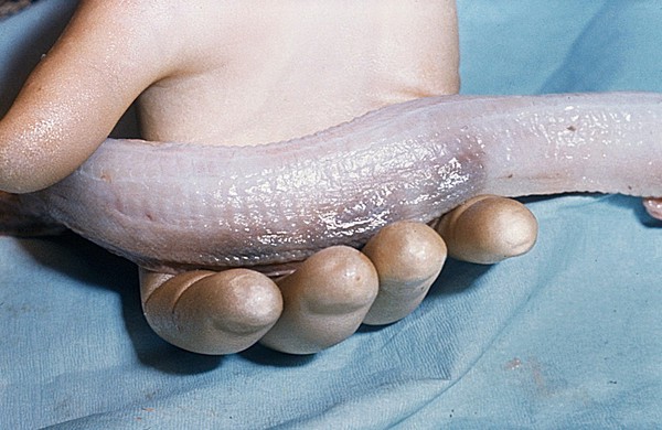 Dead Python with subcutaneous bruising