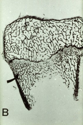 Section tibial head - copper deficient lamb