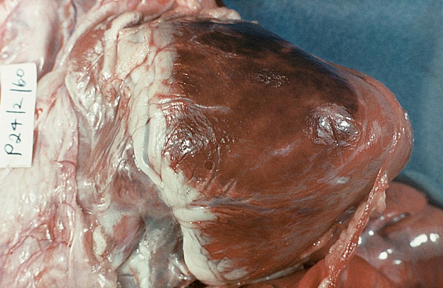A pig's heart: Mulberry heart disease; haemorrhage