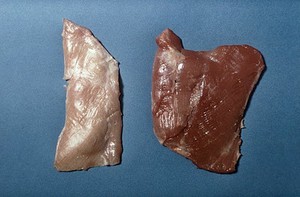 view Biceps femoris muscle lamb - musc. dystrophy