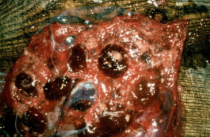 Placenta from a ewe with ewzootic abortion.