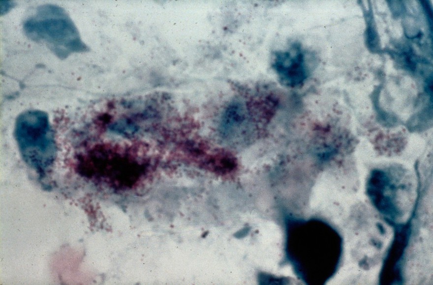 Chlamydial elementary bodies - from ewe