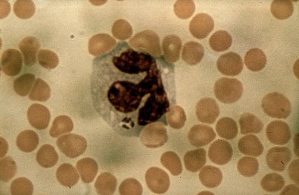 Tick-borne fever - blood smear from sheep