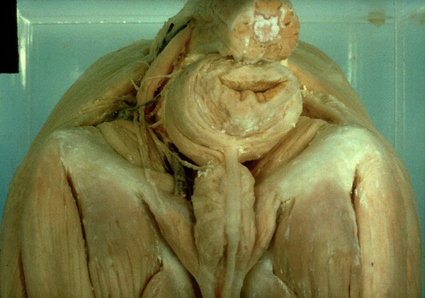 Dissection: caudal view of perineal region
