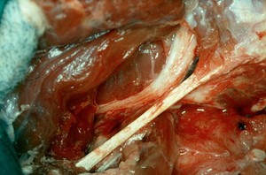 view Ligaments & nerve - perineal rupture repair