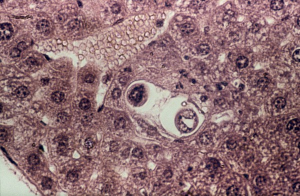 Toxocara canis larva - mouse's liver