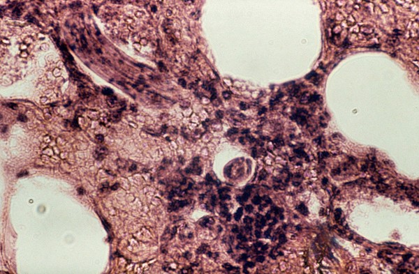 Toxocara canis larva - mouse's lung