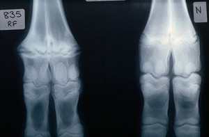 view Radiograph comparing copper deficient & not