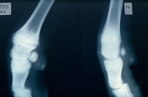 view Radiograph comparing copper deficient & not