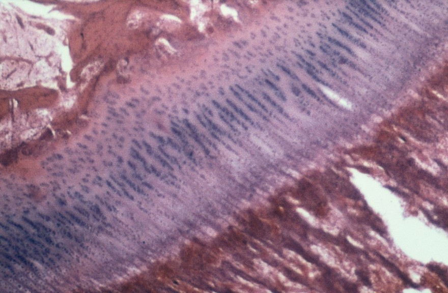 Section of normal epiphyseal plate (cow)