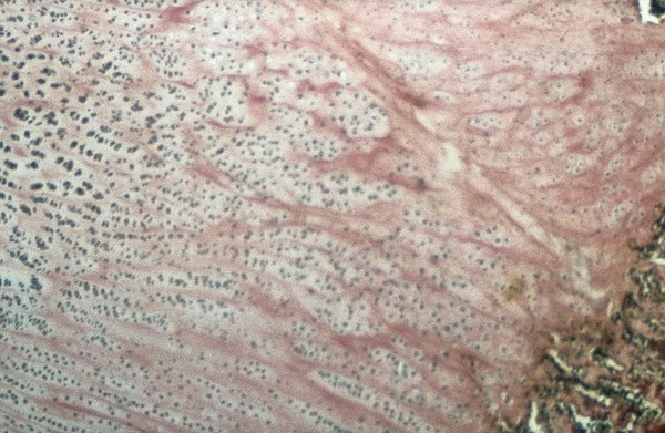 Epiphyseal plate: copper deficiency in cow