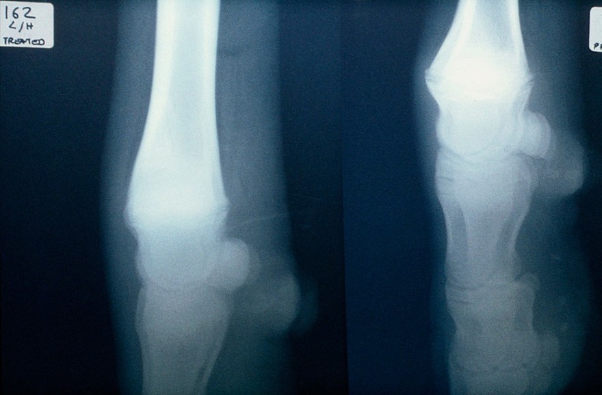 Radiograph: copper deficient fetlocks (cow)