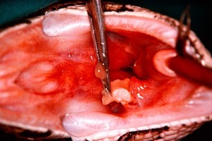 view Mouth of Python: infected ranulae