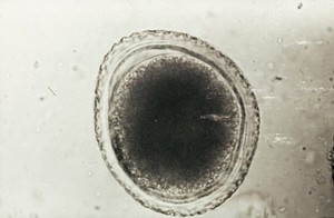 view Egg of toxocara canis (unsegmented)