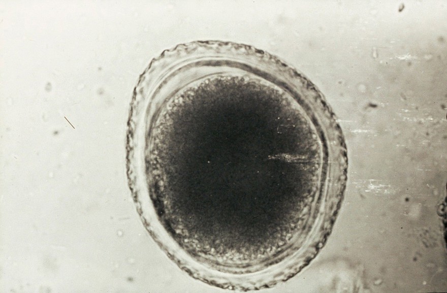 Egg of toxocara canis (unsegmented)