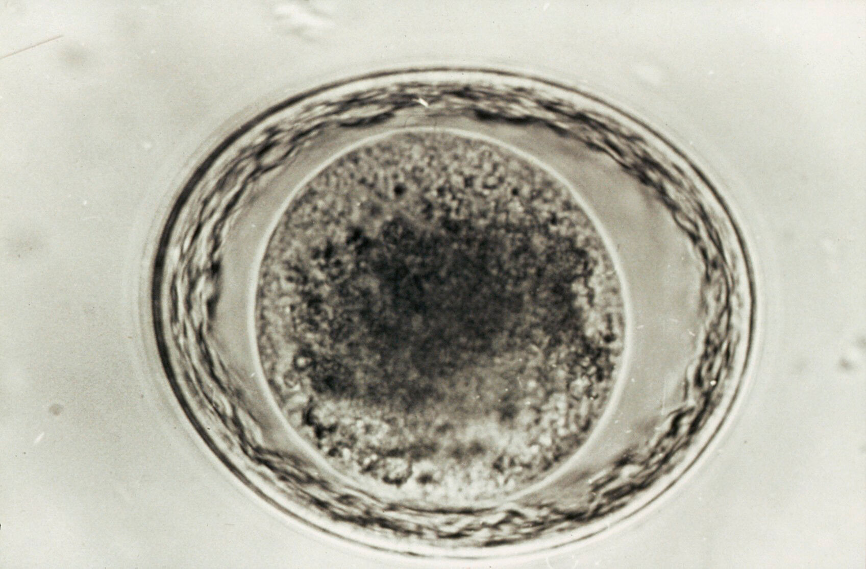 Egg Of Toxascaris Leonina Unsegmented Wellcome Collection
