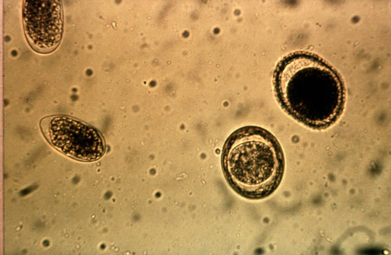 Four Nematode Eggs In A Faeces Sample (from A | Wellcome Collection