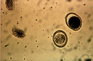 view Four nematode eggs in a faeces sample (from a