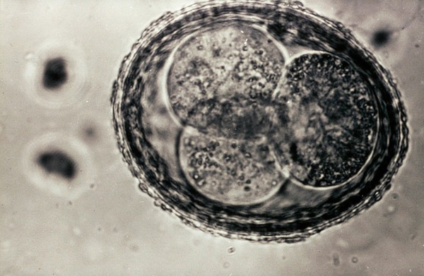 Segmented egg of toxocara canis (from a dog).