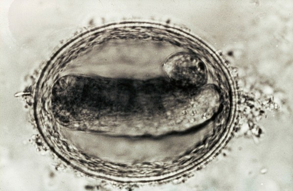 Embryonated egg of toxocara canis (from a dog).