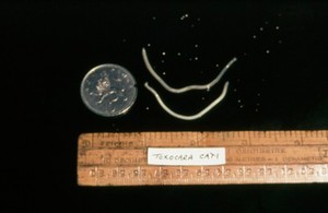 view Adult worms of toxocara cati (from a cat).