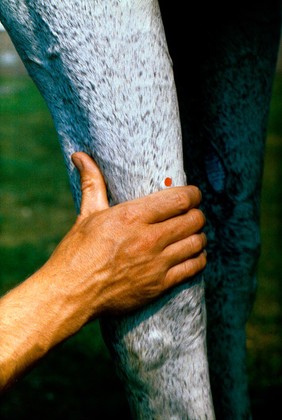 Horse's leg: ulnar nerve block.