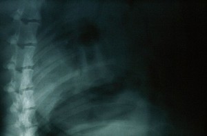 view Radiograph: poor quality taken without grid