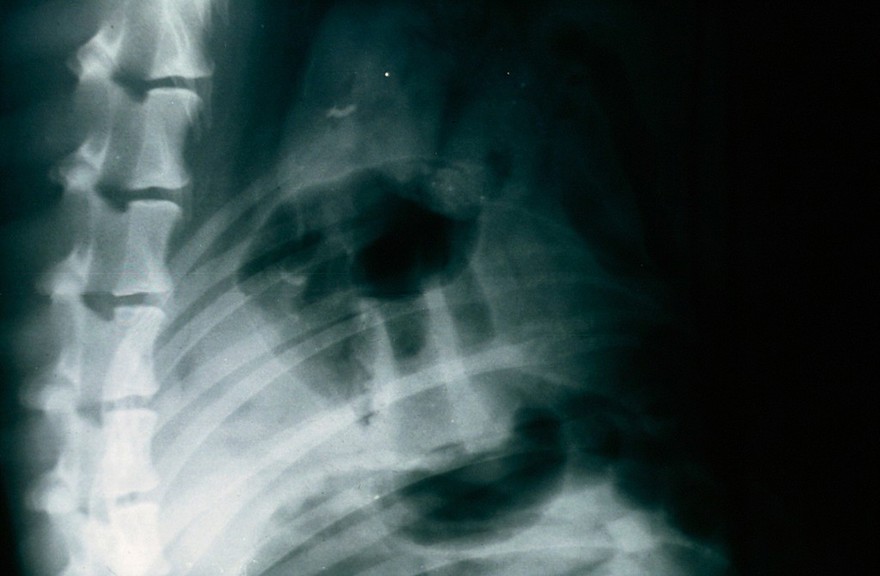 Radiograph: good quality taken with a grid