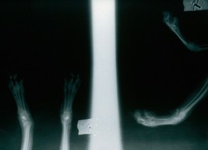 view Radiograph: focused grid used upside down.