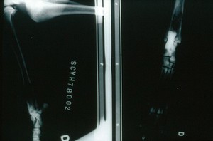 view Radiograph: over-exposed, too large beam