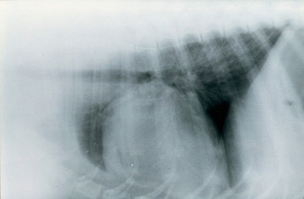 Chest radiograph produced using expiration