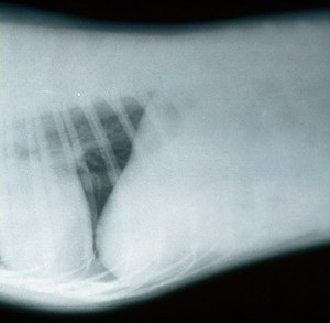 view Radiograph: under-exposed film (for spine or