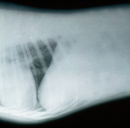 Radiograph: under-exposed film (for spine or