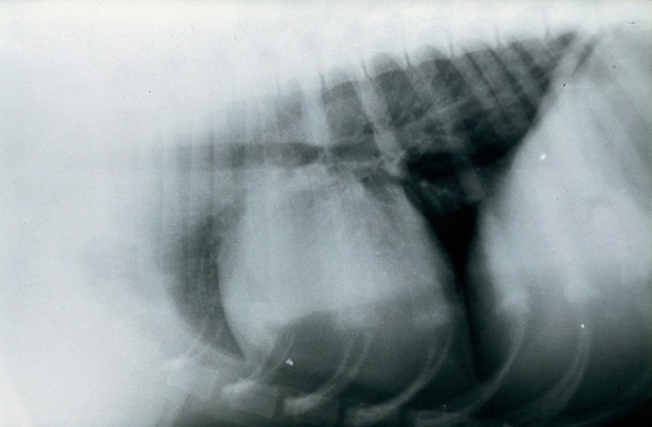 Chest radiography in inspiration, with no rotation