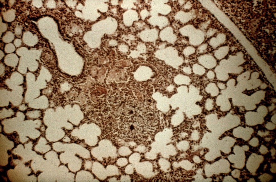 Lungworms: 4th stage larva (from a cow)