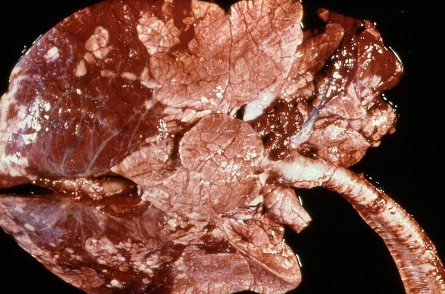 Gross pneumonia due to lungworm infection