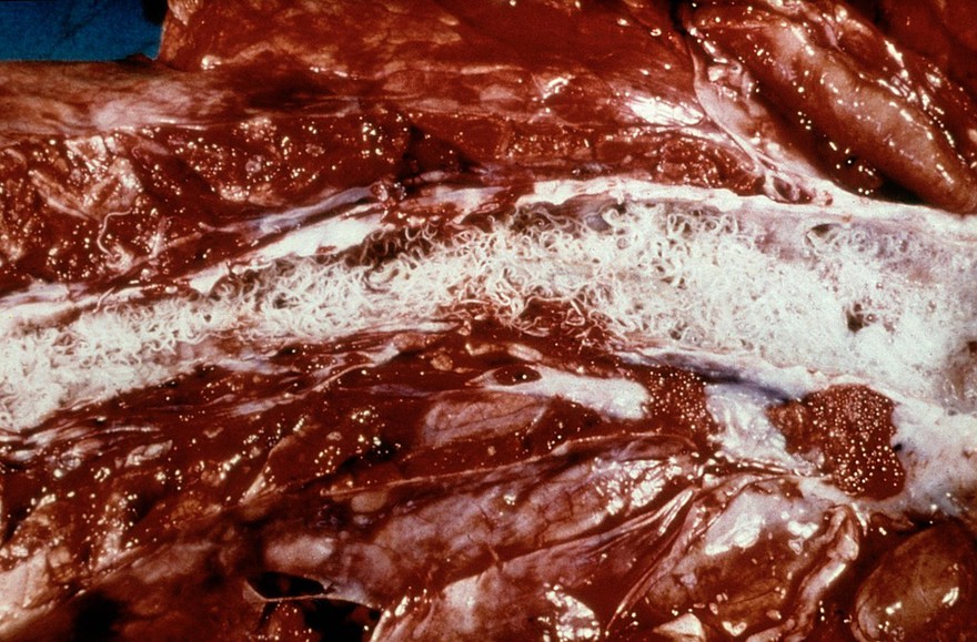Adult lungworms in frothy mucus.