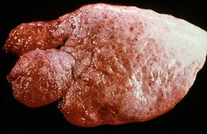 view Emphysema of lung due to lungworm infection