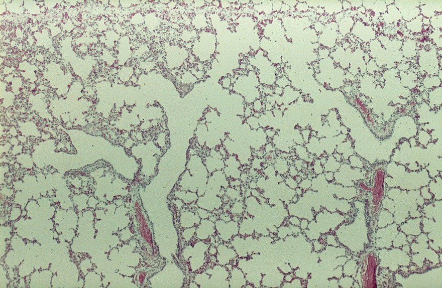Histological section of a normal cow lung