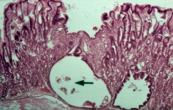 O.ostertagi in the gastric gland (cow)