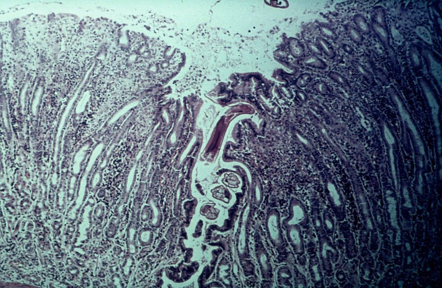 O.ostertagi in the gastric gland (cow)