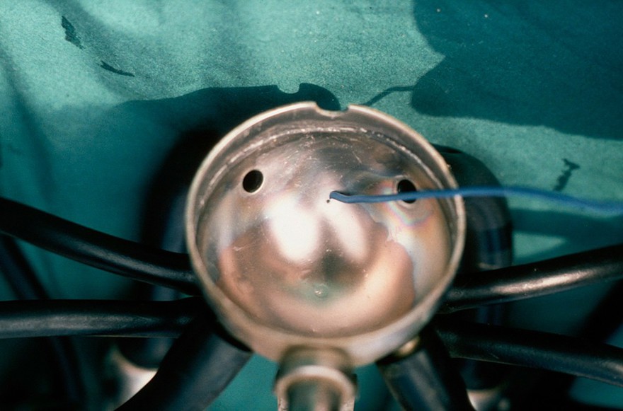 Milking machine: air-bleed hole